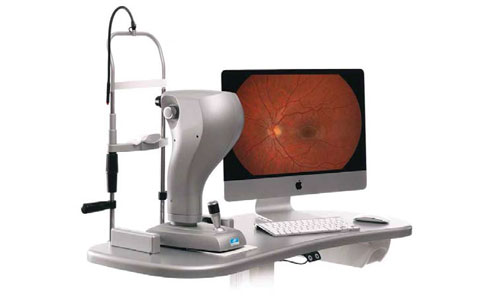 retinografía
